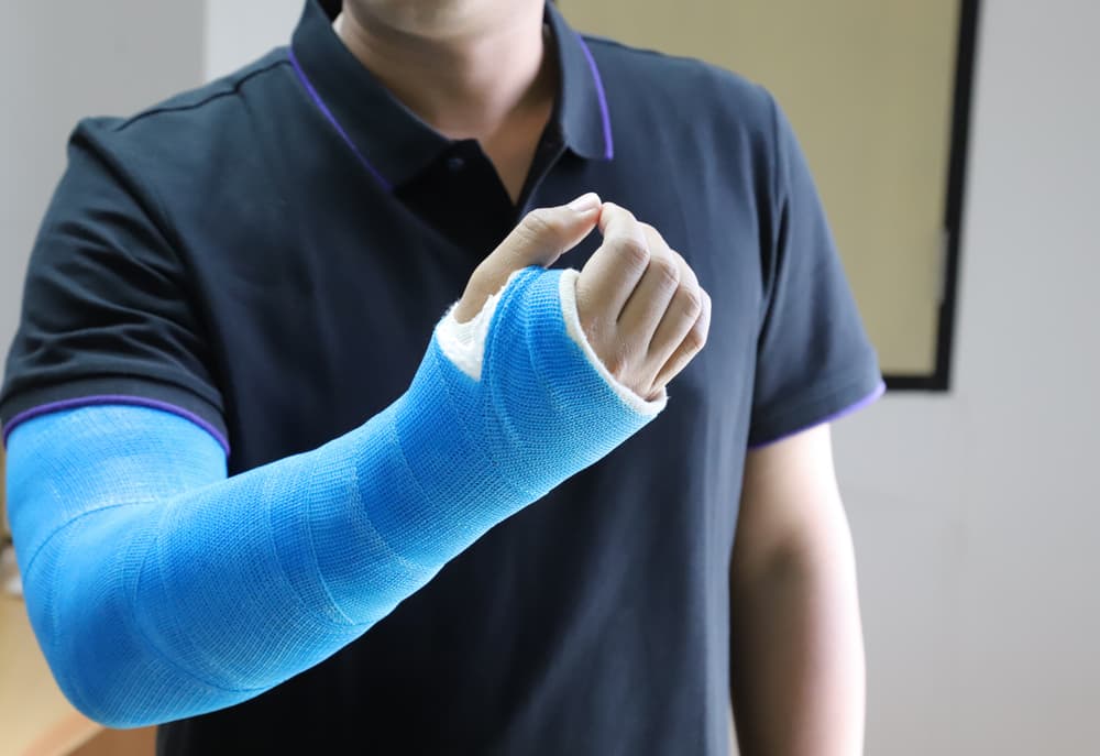 Man's arm in blue elastic bandage and fiberglass cast after motorcycle accident, receiving proper medicine treatment.